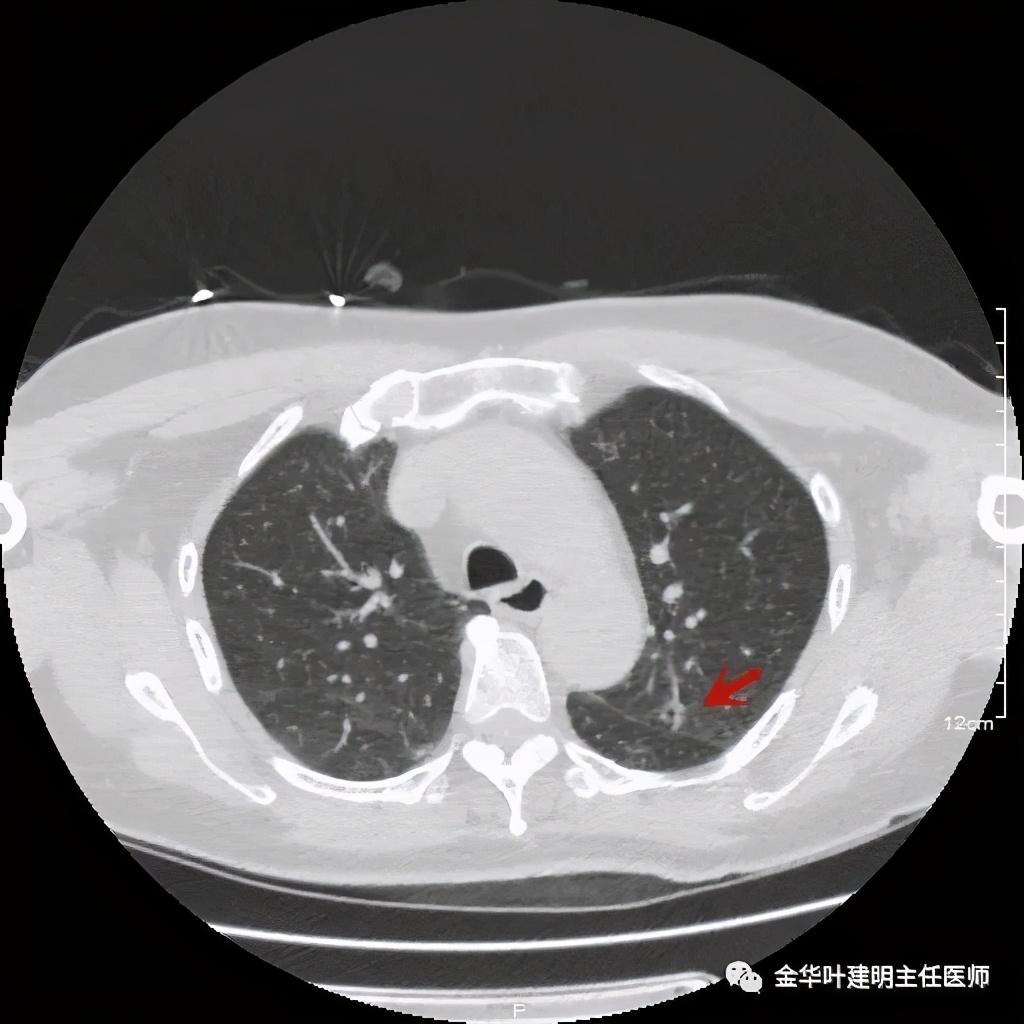 我第一次意识到玻璃的存在，是在七岁那年