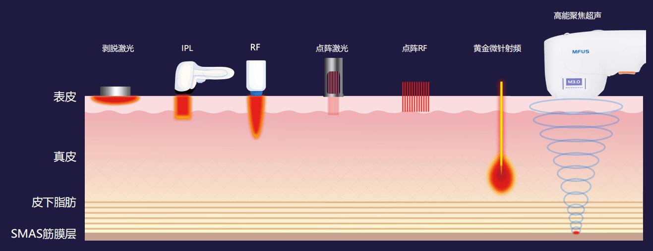 超声波里的焊天动地，骄成超声与新能源时代的隐形冠军